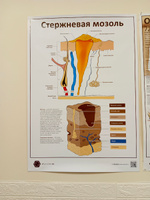 Плакат Стержневая мозоль для кабинета педикюра и подолога в формате А1 (84 х 60см), версия 2 #3, Ирина Р.