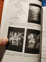 Лучевая диагностика. Позвоночник, 3-е издание | Соммер Оливер, Гернет Андреас М. #3, Ксения