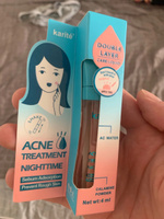 Точечное средство от прыщей KARITE acne treatment nighttime #1, Николай А.