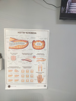 Плакат Ногти человека в кабинет педикюра и подолога в формате А1 (84 х 60 см) #6, Елена Ж.