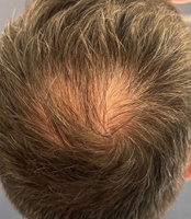 Масло Hair Growth Serum / Сыворотка для роста волос, для бороды, восстановление, активатор роста, против выпадения, уход за волосами / 55 мл #8, Герман З.