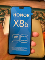 Honor Смартфон X8b 8/128 ГБ, зеленый #32, Андрей З.