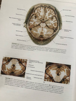 Клиническая нейроанатомия и неврология по Фицджеральду | Мтуи Эстомих, Грюнер Грегори #8, Алина К.