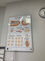 Плакат Ногти человека в кабинет педикюра и подолога в формате А1 (84 х 60 см) #4, Тамара П.