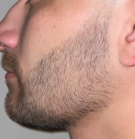 ROST BLACK 5% Средство для роста бороды волос и усов / Сыворотка против облысения у мужчин / Лосьон от выпадения волос #8, Александр Ц.