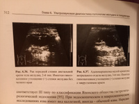 Ультразвуковая диагностика в гастроэнтерологии #2, Алена Беспалова