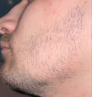 ROST BLACK 5% Средство для роста бороды волос и усов / Сыворотка против облысения у мужчин / Лосьон от выпадения волос #2, Александр Ц.