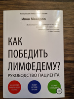 Как победить лимфедему? #1, Светлана Г.