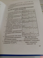 Азбука ЭКГ и боли в сердце | Зудбинов Юрий Иванович #3, Елена К.