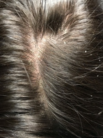 19LabCosmetics Пилинг для кожи головы, 150 мл #2, anastasia grivtsova