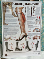 Плакат Осторожно, каблуки в формате А1 (84 х 60 см) для кабинета педикюра и подолога #8, Анна Белкина