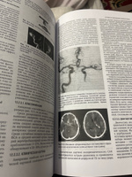 Неврология. Национальное руководство. В 2 т. Т. 1. 2-е изд., перераб.и доп #2, Ильяс М.