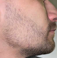 ROST BLACK 5% Средство для роста бороды волос и усов / Сыворотка против облысения у мужчин / Лосьон от выпадения волос #4, Александр Ц.