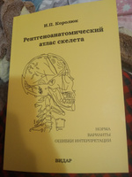 Рентгеноанатомический атлас скелета (норма, варианты, ошибки интерпретации). 2-е издание , перераб. и доп. #1, Елена Г.