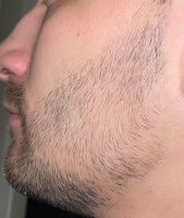 ROST BLACK 5% Средство для роста бороды волос и усов / Сыворотка против облысения у мужчин / Лосьон от выпадения волос #5, Александр Ц.