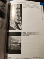 Лучевая диагностика. Позвоночник, 3-е издание | Соммер Оливер, Гернет Андреас М. #4, Ксения