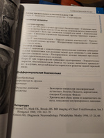 Лучевая диагностика. Позвоночник, 3-е издание | Соммер Оливер, Гернет Андреас М. #5, Ксения