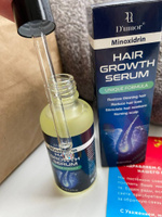 Масло Hair Growth Serum / Сыворотка для роста волос, для бороды, восстановление, активатор роста, против выпадения, уход за волосами / 55 мл #7, Артемий Г.