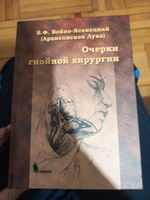 Очерки гнойной хирургии. 4-е изд. | Святитель Лука Крымский (Войно-Ясенецкий), Архиепископ Лука (Войно-Ясенецкий) Валентин Феликсович #8, Девлетхан К.