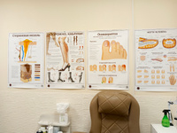 Плакат Стержневая мозоль для кабинета педикюра и подолога в формате А1 (84 х 60см), версия 2 #4, Ирина Р.