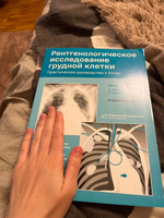 Рентгенологическое исследование грудной клетки. Практическое руководство. Атлас | Хофер Матиас #2, Елена С.