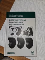 Компьютерная томография в пульмонологии #3, Елена Б.