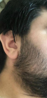 Масло Hair Growth Serum / Сыворотка для роста волос, для бороды, восстановление, активатор роста, против выпадения, уход за волосами / 55 мл #36, Витя В.