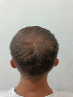 BLESVASH Лосьон для волос, 360 мл #115, Дмитрий К.