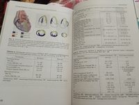 Эхокардиография в норме для начинающих от Рыбаковой | Рыбакова Марина Константиновна #4, Елена Г.